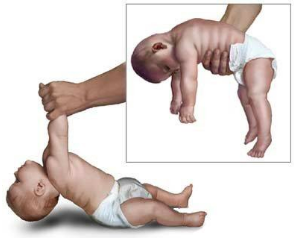 samtale Modtagelig for dybtgående Low Muscle Tone in Babies - Chicago Pediatric Therapy & Wellness Center