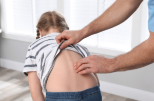 Commonly Asked Questions after a Scoliosis Diagnosis