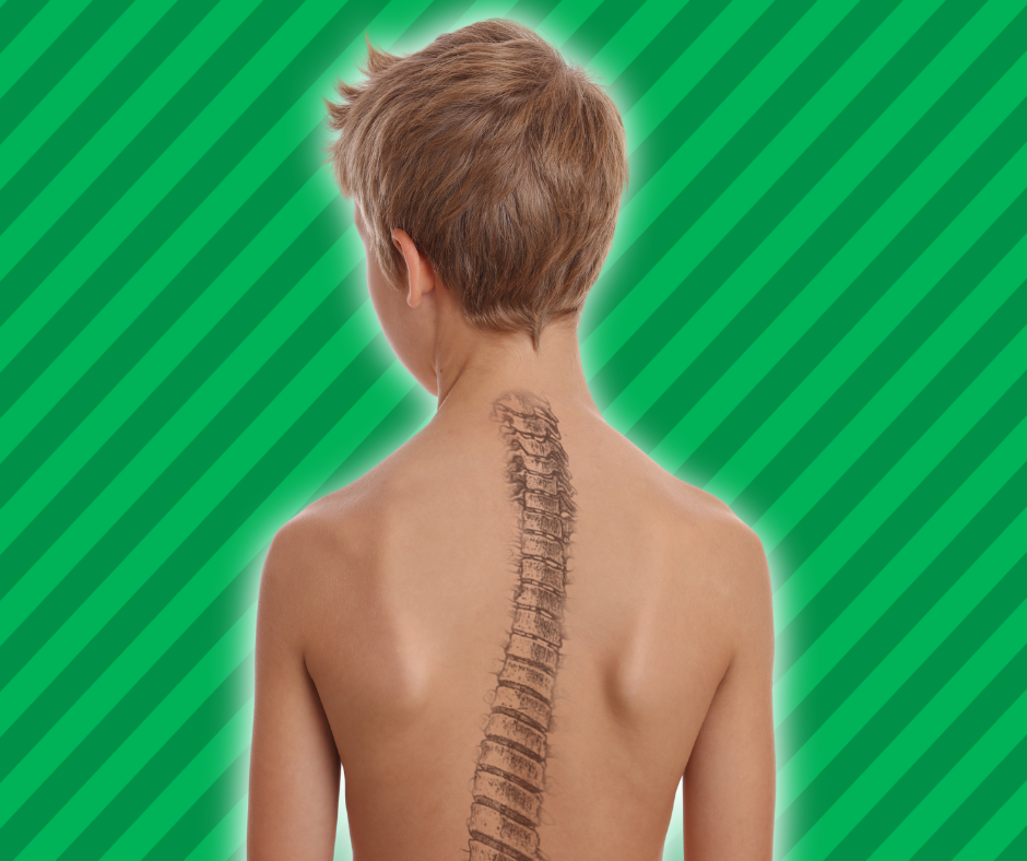Child and spine shown to show improper alignment